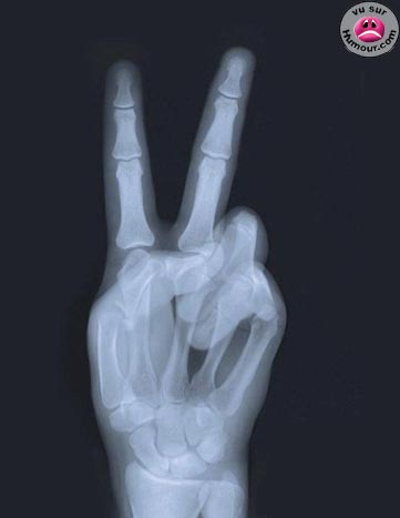 peace